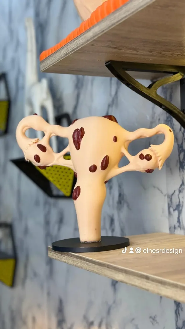 The finished anatomical model, front view
